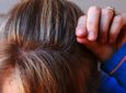 Οι κυριότεροι λόγοι που γκριζάρουν τα μαλλιά σε μικρή ηλικία