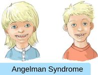 15η Φεβρουαρίου: Παγκόσμια Ημέρα για το Σύνδρομο Angelman