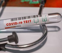 Συνεχίζονται τα test Covid-19 από την ΚΟΜΥ Κω (το πρόγραμμα από 23-27/5)