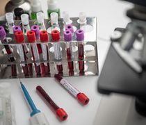 Έρχεται rapid τεστ για τον ιό του Δυτικού Νείλου    