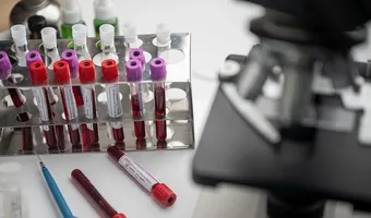  Κορονοϊός: Αρχίζουν ξανά οι δοκιμές του εμβολίου από την AstraZeneca