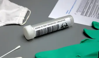 ΑΡΝΗΤΙΚΑ ΟΛΑ ΤΑ ΣΗΜΕΡΙΝΑ RAPID TESTS ΣΤΗΝ ΚΑΡΔΑΜΑΙΝΑ