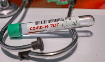 Συνεχίζονται τα test Covid-19 από την ΚΟΜΥ Κω (το πρόγραμμα από 23-27/5)