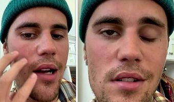 Justin Bieber: Σοβαρό πρόβλημα υγείας - Πάσχει από το σύνδρομο Ramsay Hunt και παρέλυσε το μισό πρόσωπό του (vid)