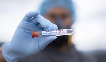 Έρχεται το τέλος στα rapid test των ανεμβολίαστων εργαζόμενων - Τι ανακοίνωσε ο Θ. Πλεύρης