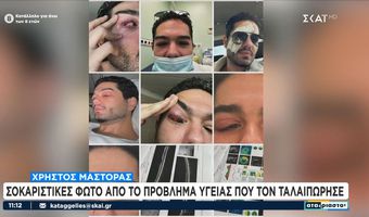 Χρ. Μάστορας: Σοκαριστικές φωτογραφίες από το πρόβλημα υγείας που τον ταλαιπώρησε