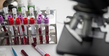 Κοροναϊός: Νέο τεστ ανιχνεύει τα αντισώματα στα ούρα και όχι στο αίμα