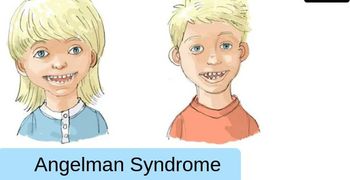 15η Φεβρουαρίου: Παγκόσμια Ημέρα για το Σύνδρομο Angelman