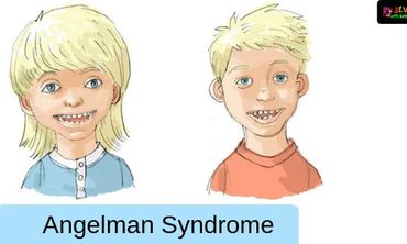 15η Φεβρουαρίου: Παγκόσμια Ημέρα για το Σύνδρομο Angelman