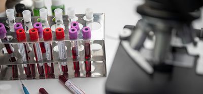Κοροναϊός: Νέο τεστ ανιχνεύει τα αντισώματα στα ούρα και όχι στο αίμα