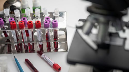 Έρχεται rapid τεστ για τον ιό του Δυτικού Νείλου    