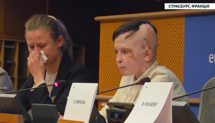 «Συγκλόνισε» το Ευρωκοινοβούλιο η μαρτυρία 11χρονου Ουκρανού που ζει από θαύμα και μεγαλουργεί - «Η τελευταία φορά που είδα τη μαμά μου»