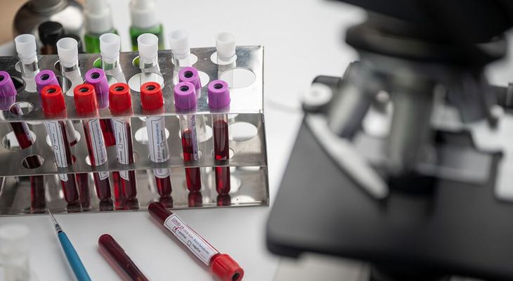 Απάντηση της ΝΔ Κω στην ΝΕ ΠΑΣΟΚ: Με παρέμβαση του Υπ. Υγείας επέστρεψε ένας μικροβιολόγος στον ΕΟΠΥΥ